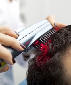 Does Laser Hair Growth Therapy Work?