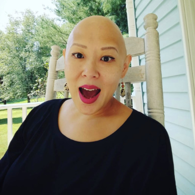 Two Women Experiencing Hair Loss Share Their Experience