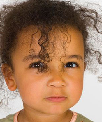 How to Treat Lice on Curly Hair