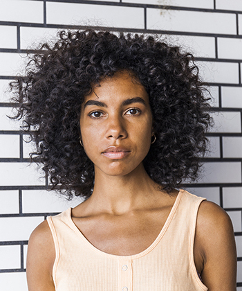 How to Treat Seborrheic Dermatitis with Curly Hair
