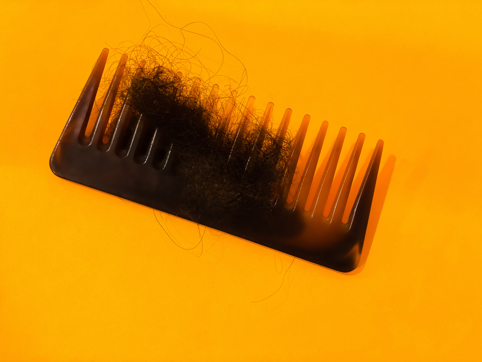 Ask a Curl Expert: “Why is My Hair Falling Out So Much?”